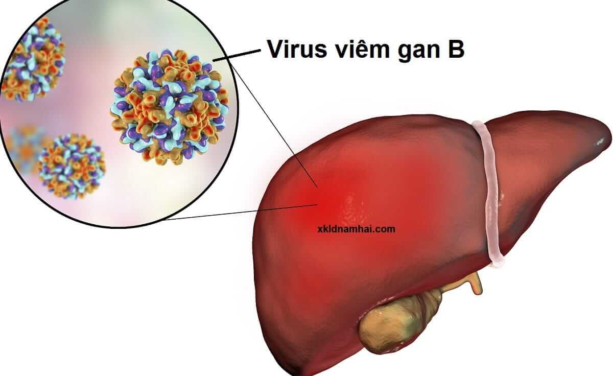 Virus viêm gan B
